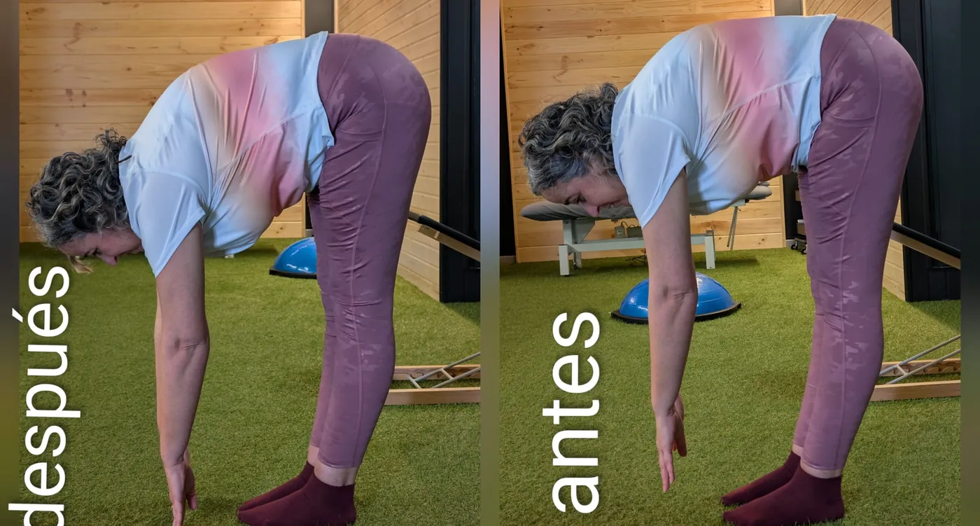 Antes y después de una clienta con escoliosis: flexión del tronco hacia delante, más cerca del suelo tras las sesiones de hamaca postural